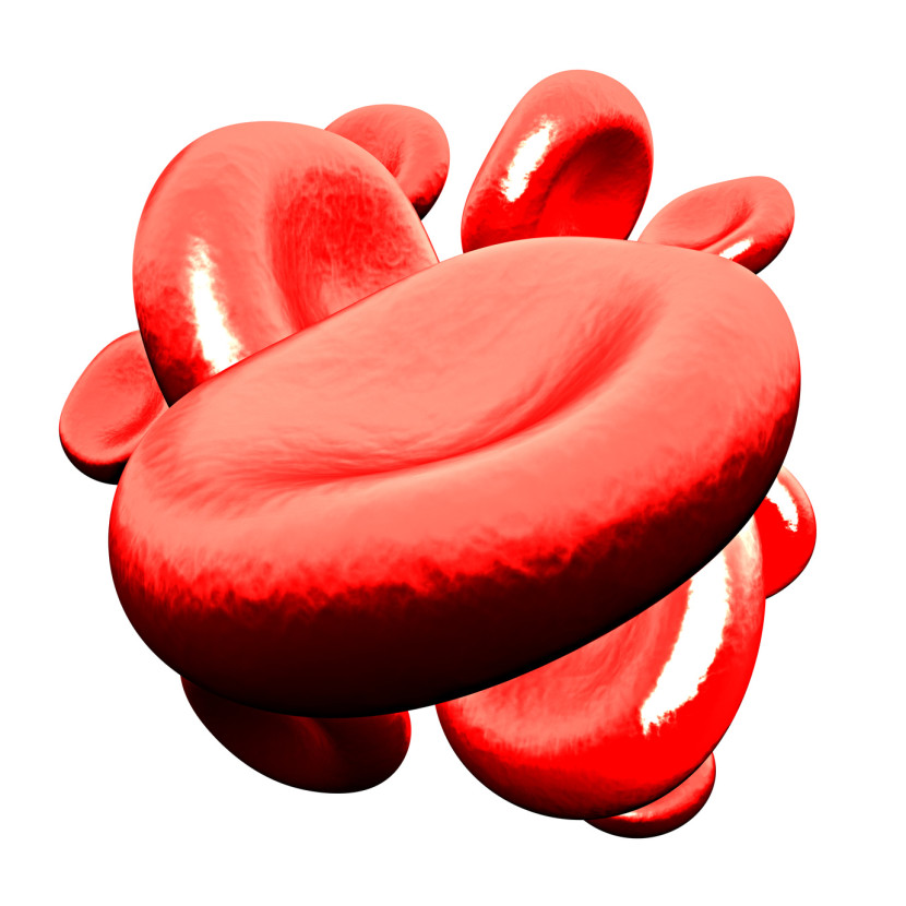 טרומבוציטופניה